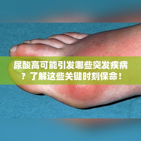 尿酸高可能引发哪些突发疾病？了解这些关键时刻保命！