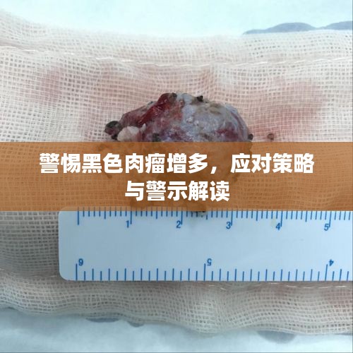 警惕黑色肉瘤增多，应对策略与警示解读
