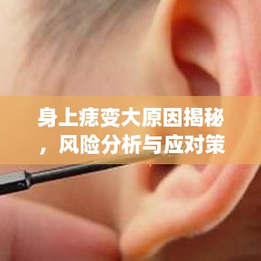 身上痣变大原因揭秘，风险分析与应对策略