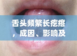 舌头频繁长疙瘩，成因、影响及治疗方法解析