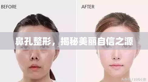 鼻孔整形，揭秘美丽自信之源